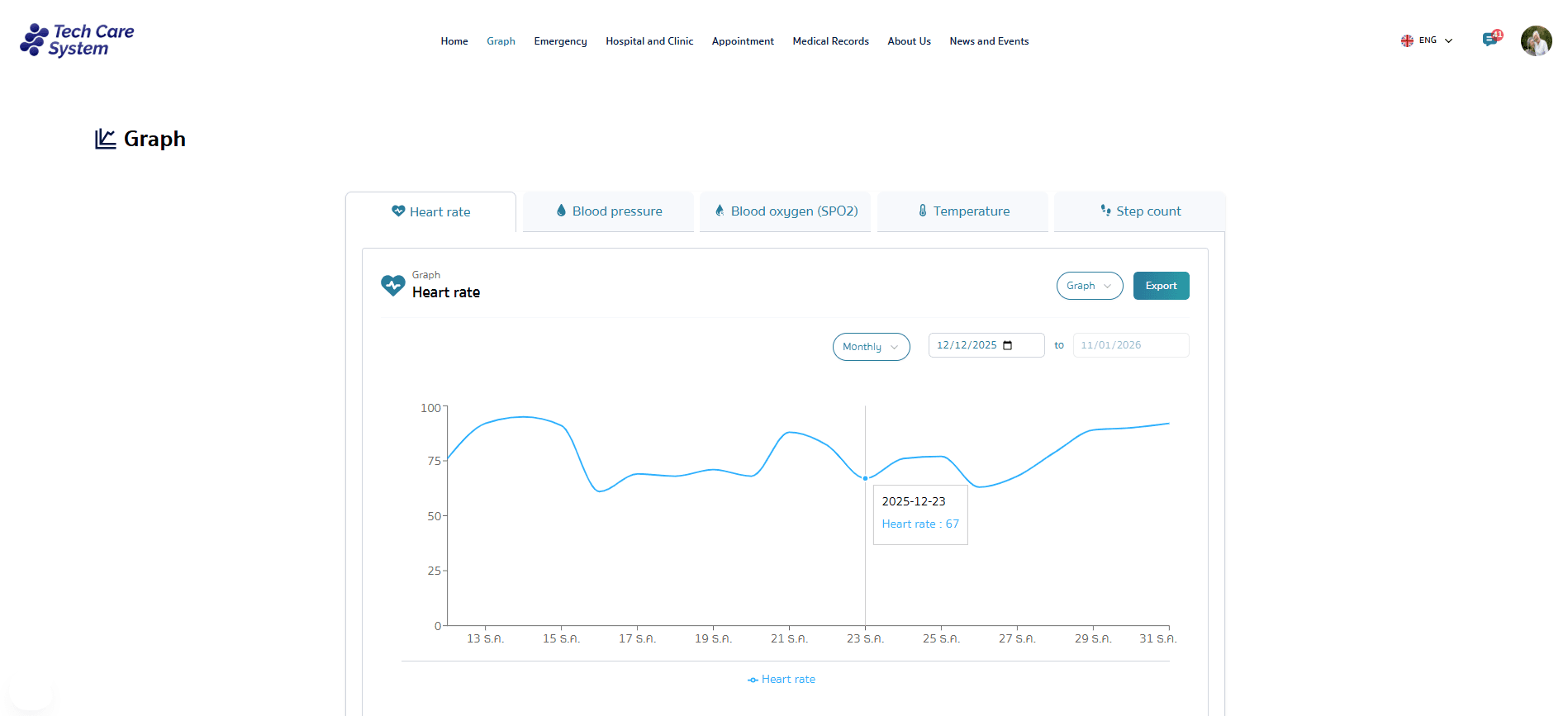 กราฟและตาราง